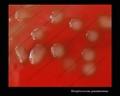 virulent mucoid colonies of Streptococcus pneumoniae